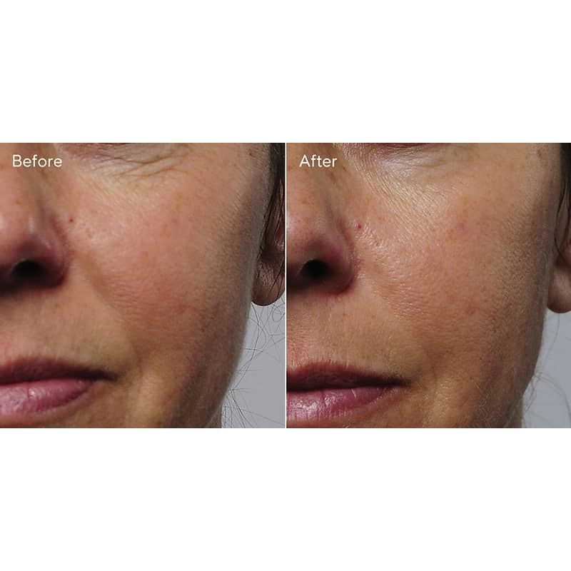 Rapid Collagen Infusion by Murad