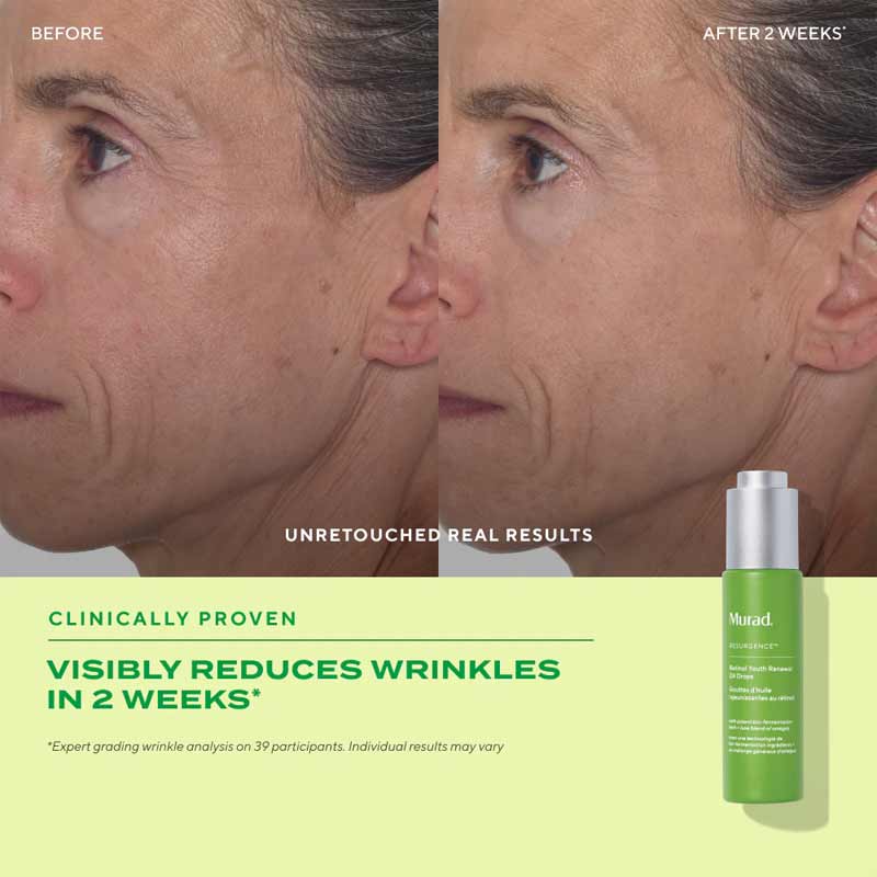 Resurgence Retinol Youth Renewal Oil Drops by Murad