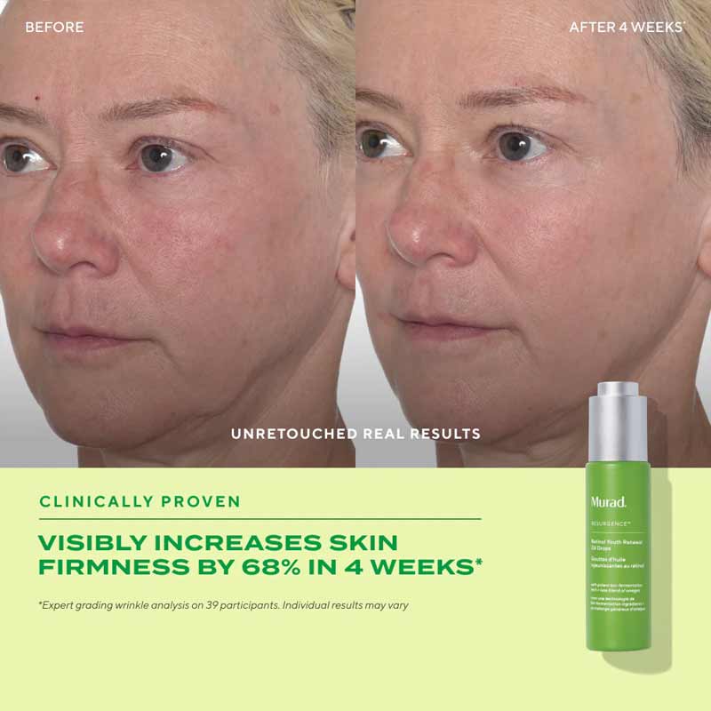 Resurgence Retinol Youth Renewal Oil Drops by Murad