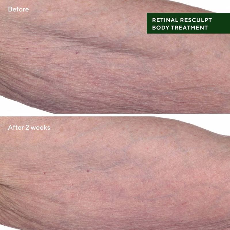 Retinal ReSculpt Body Treatment by Murad