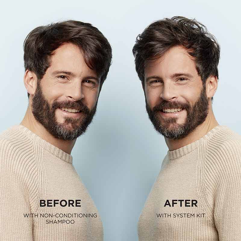 System 1 Scalp & Hair Treatment by Nioxin