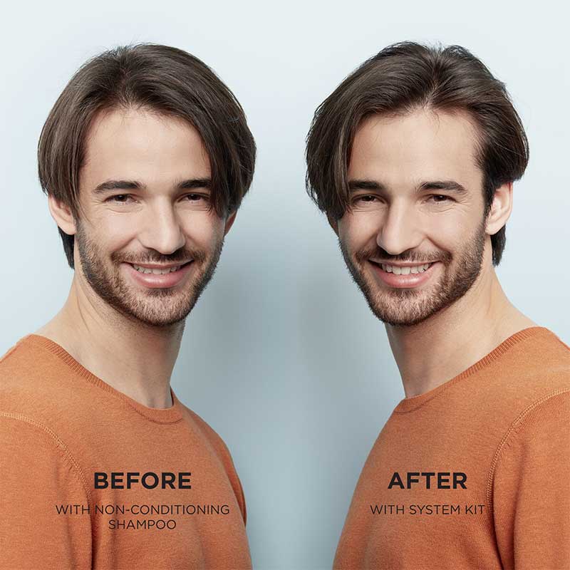 System 1 Scalp & Hair Treatment by Nioxin