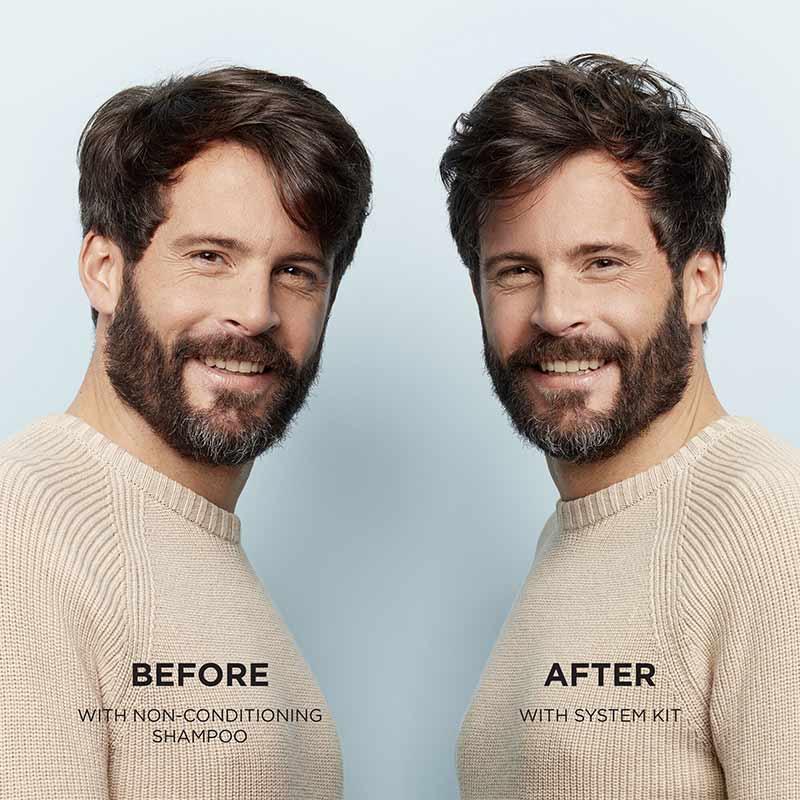 System 2 Scalp Revitaliser Conditioner by Nioxin