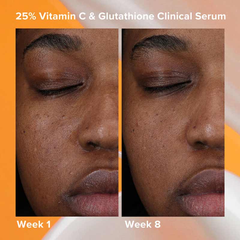 25% Vitamin C + Glutathione Clinical Serum by Paula's Choice