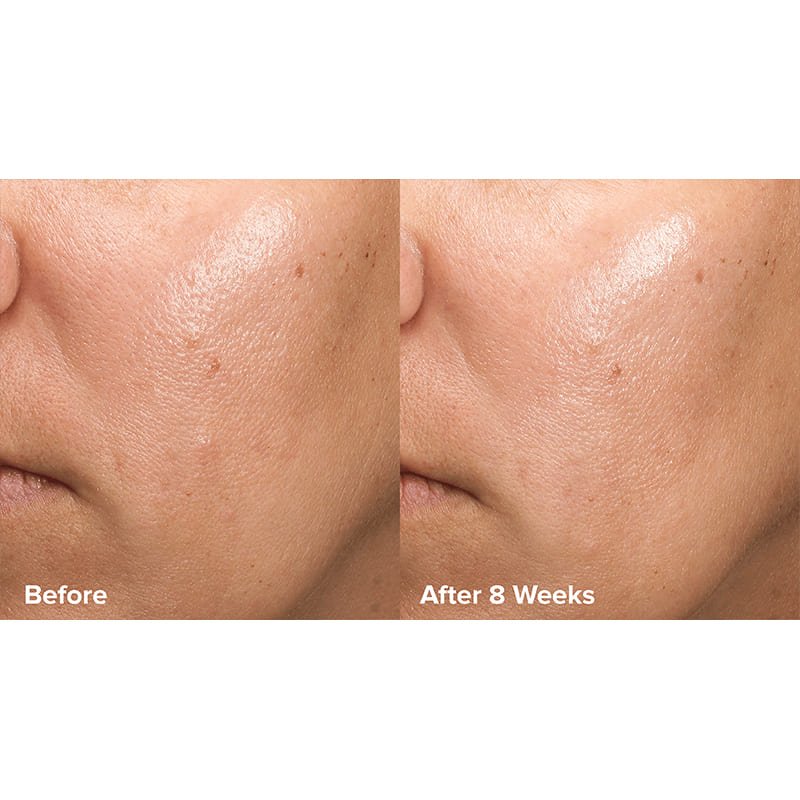 Skin Perfecting 6% Mandelic Acid + 2% Lactic Acid Liquid Exfoliant Travel Size by Paula's Choice