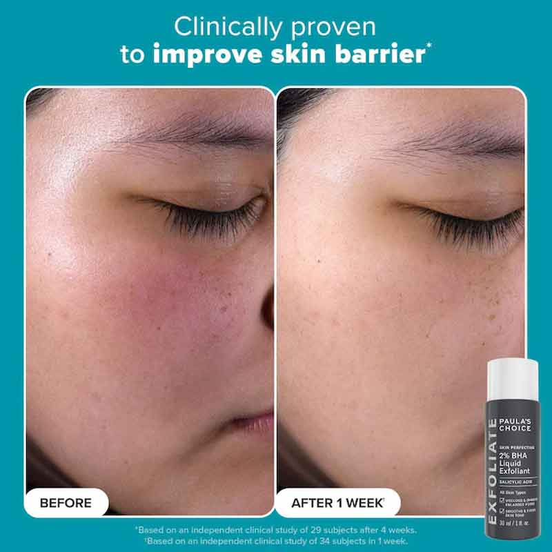 The Exfoliation Icons Kit by Paula's Choice