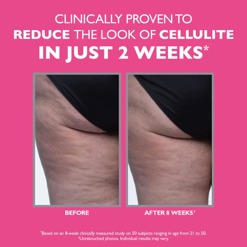 Firmx Tight & Toned Cellulite Treatment by Peter Thomas Roth