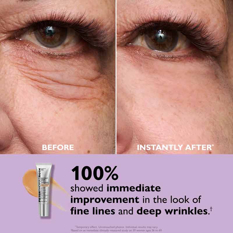 Instant FIRMx Temporary Eye Tightener by Peter Thomas Roth
