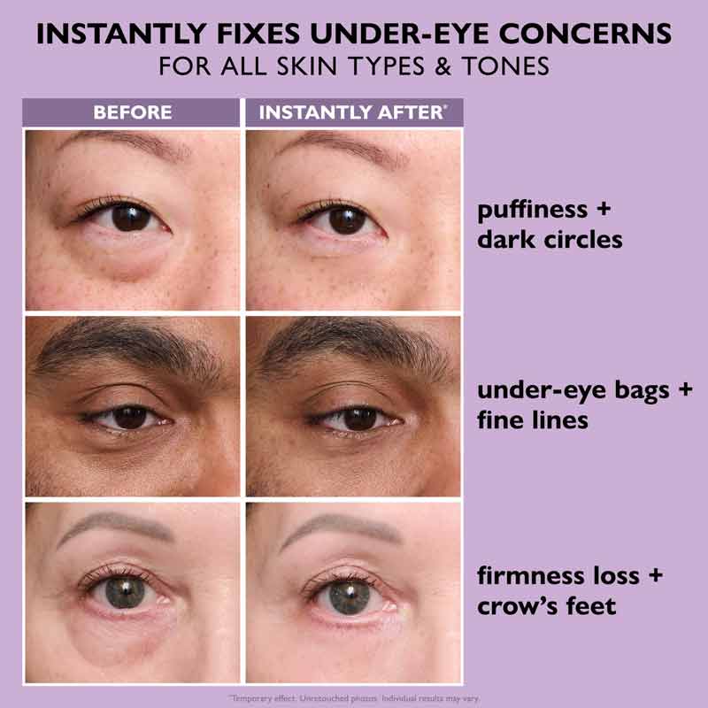 Instant FIRMx Temporary Eye Tightener by Peter Thomas Roth