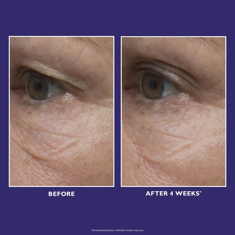 Ultimate Solution 5 Multitasking Eye Cream 15ml