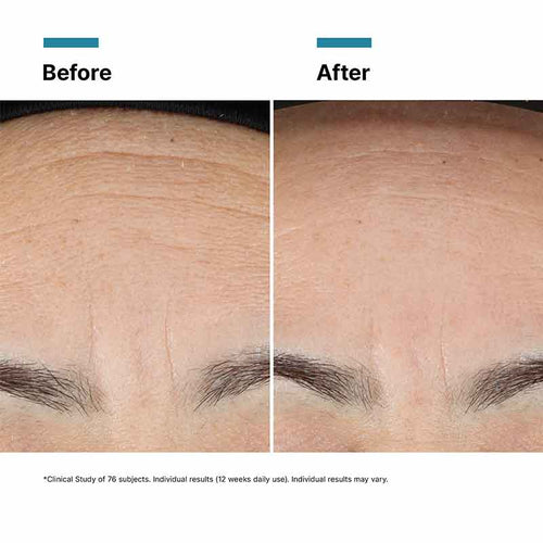 Advanced RGN-6 Rejuvenating Skin Cream by SkinCeuticals