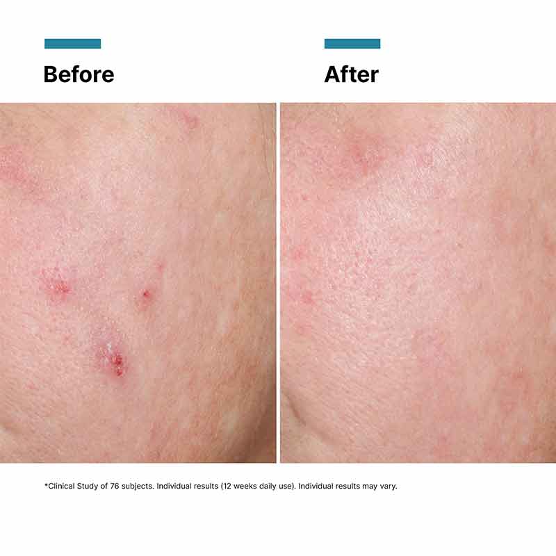 Advanced RGN-6 Rejuvenating Skin Cream by SkinCeuticals