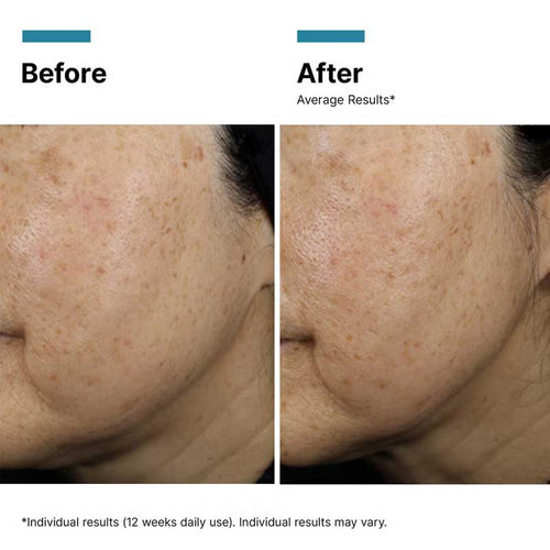 A.G.E. Interrupter Ultra Serum by SkinCeuticals