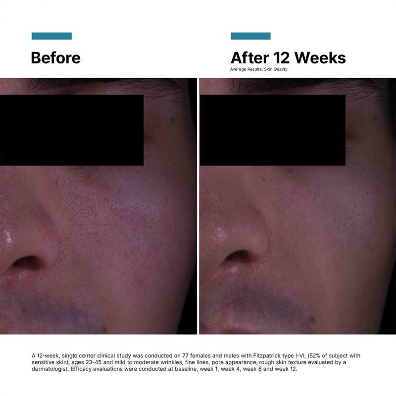 P-TIOX Anti-Wrinkle Cream by SkinCeuticals