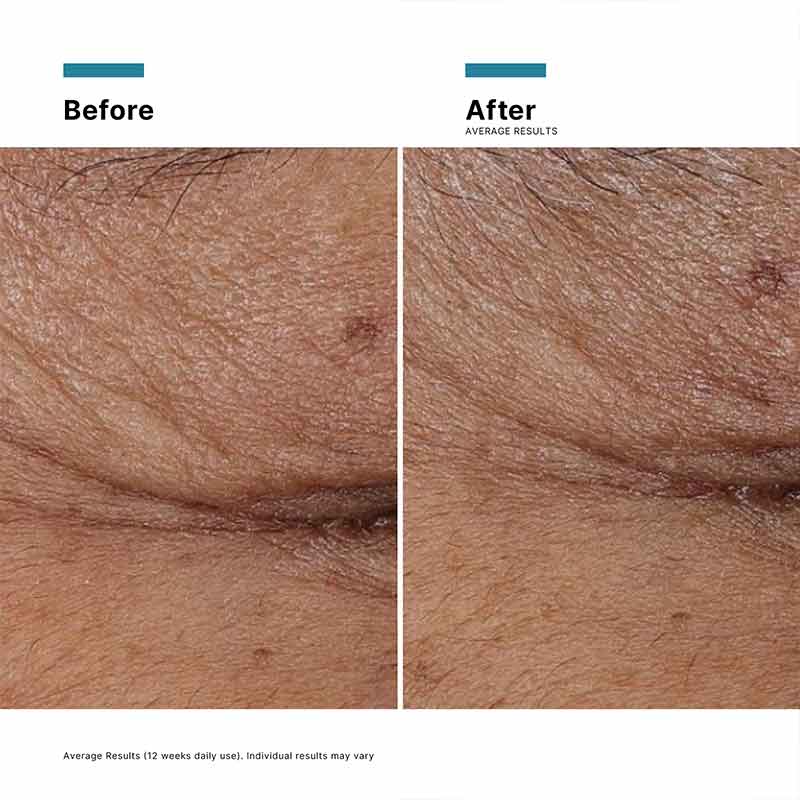 P-TIOX Anti-Wrinkle Peptide Serum by SkinCeuticals