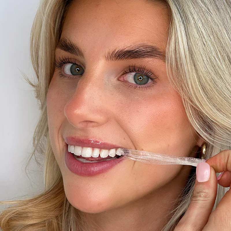 Ultra Teeth Whitening Strips 14 Day by Spotlight Oral Care