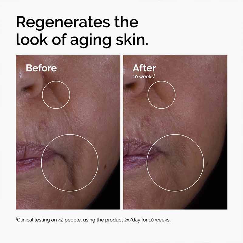 GF 15% Solution Growth Factor Serum by The Ordinary