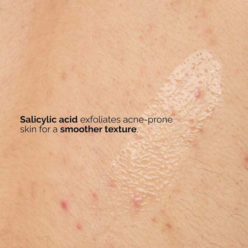 Salicylic Acid 0.5% Body Serum by The Ordinary