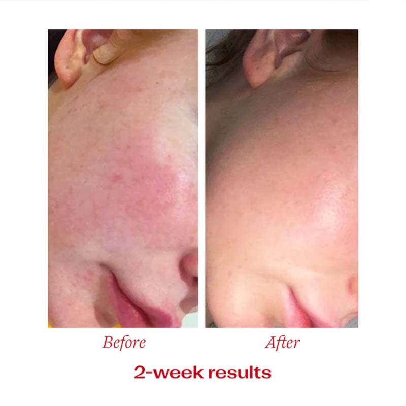 Vitamin C Booster Treatment by Trilogy